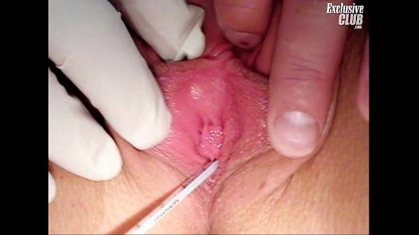 Teen Britney's intense gyno exam with speculum